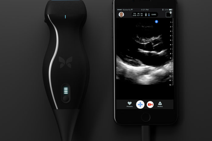 This startup is using artificial intelligence and AR to revolutionize medical imaging with portable, smartphone-connected ultrasound scanner