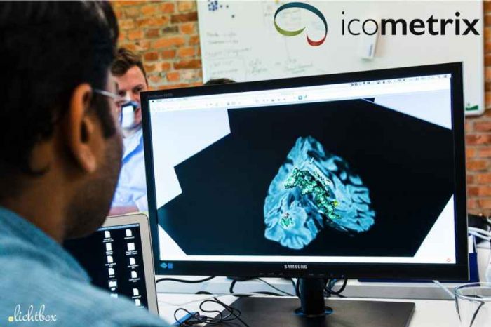 Brain imaging AI startup Icometrix raises $18 million in new funding to transform care for patients with brain disorders and injuries