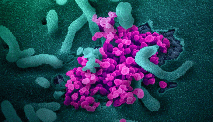 Coronavirus Explained: The best explainer video about COVID-19