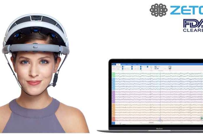 Healthtech startup Zeto raises $7.3M Series A funding to transform EEG for hospitals with its wireless, zero-prep electrode headset