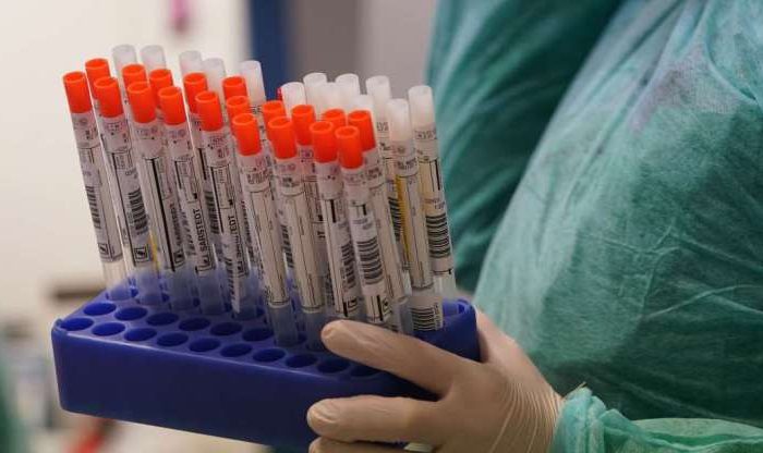 FDA approves first antibody blood test in the U.S. to detect coronavirus, the test might exempt you from social distancing—if you pass and potentially get people back to work