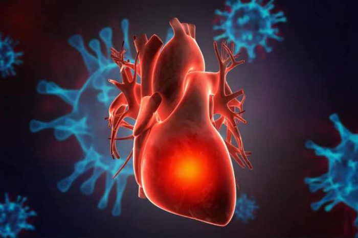 American Heart Association (AHA) is now warning that mRNA vaccines 'dramatically increase the inflammation on the endothelium (inner heart membrane)' after a new study of 566 patients found that risks of severe problems increased to 1 in 4, compared to 1 in 9 before