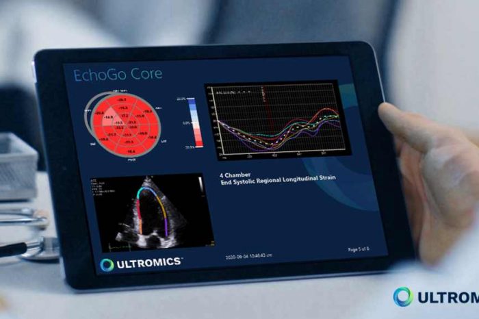 Oxford University spinoff Ultromics gets $33M Series B funding to help clinicians diagnose cardiovascular disease with AI-powered echocardiography