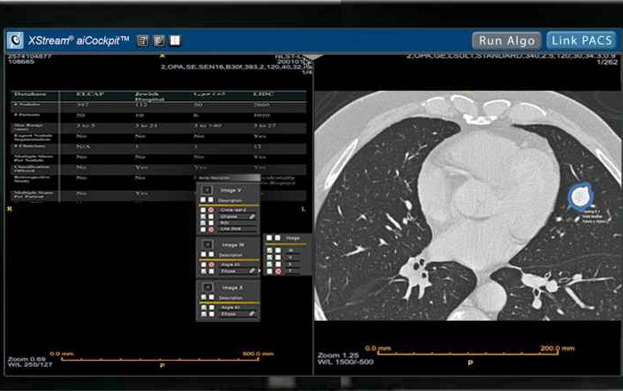 Fovia Ai launches XStream aiCockpit and XStream aiPlatform to provide radiologists and clinicians access to customized AI-driven workflows and visualizations