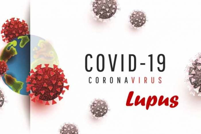 Does the study show Lupus patients using hydroxychloroquine not getting COVID-19?