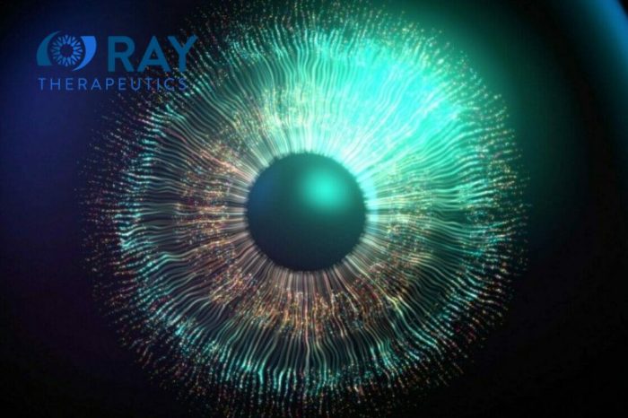 Ray Therapeutics secures $4M from CIRM to develop optogenetic therapy treatment for geographic atrophy